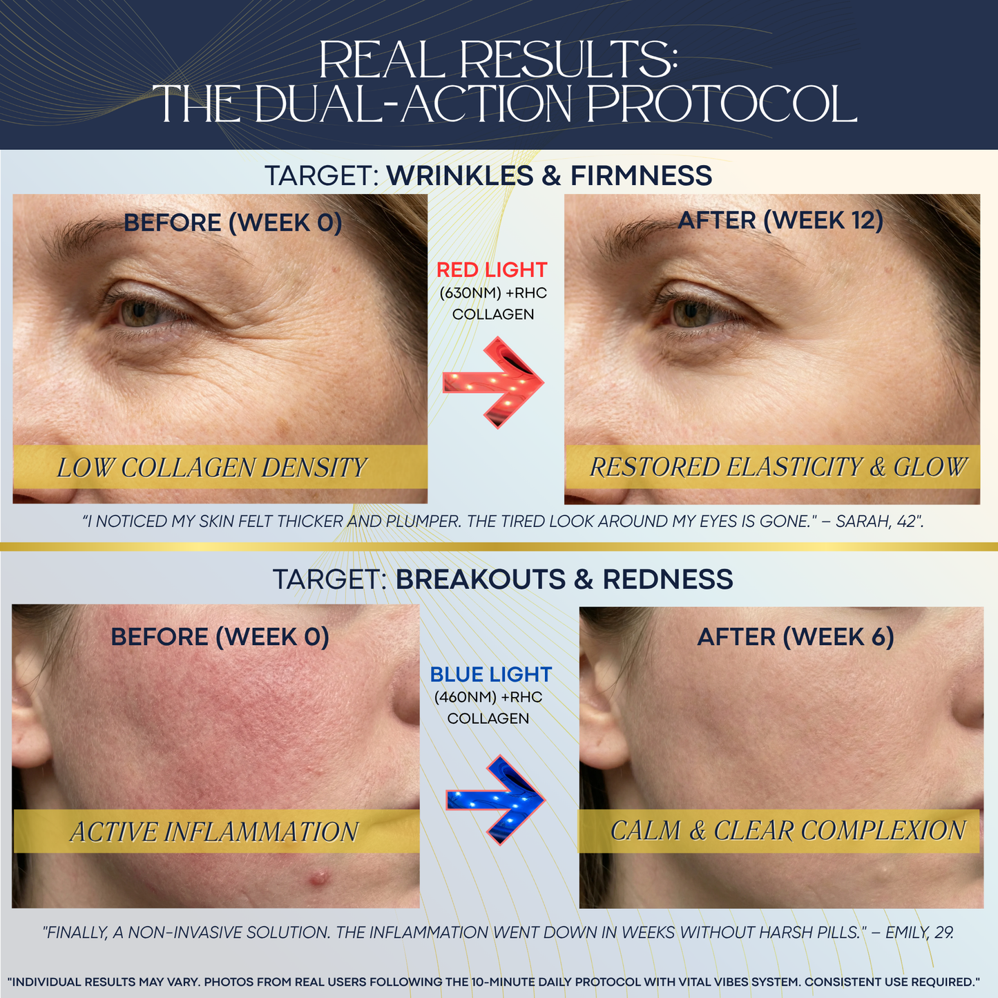 Red Light Therapy Mask + Collagen Serum Included